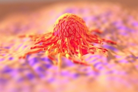 Fotó: 123rf-archív