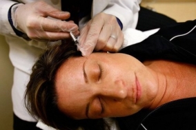 Migrénkezelés Botox-szal