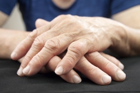 ízületi rheumatoid arthritis kezelésére szolgáló gyógyszerek