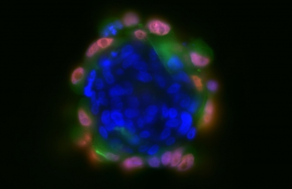 A szferoid apró, 3D-s sejttenyészet, amelyet laboratóriumi körülmények között növesztenek (Fotó: HUN-REN Szegedi Biológiai Kutatóközpont)