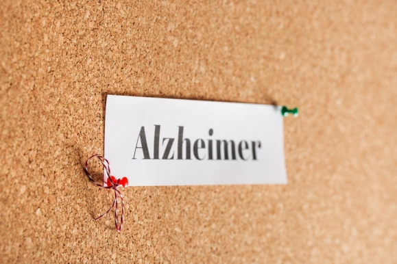 A dohányzás Alzheimer-kórhoz vezet