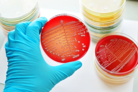 Colonies of bacteria in culture medium plate (Forrás: 123rf)