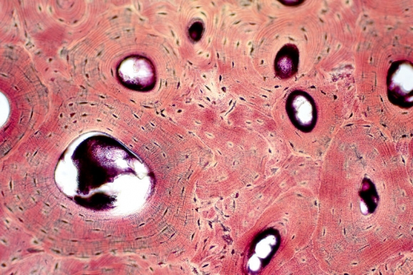 Histology of human compact bone tissue under microscope view for education, muscle bone connection and connective tissue (Forrás: 123rf)