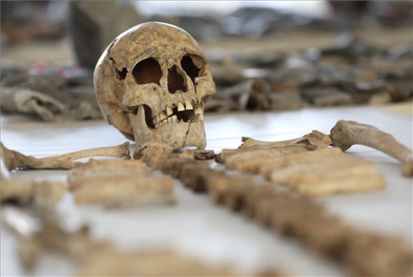 Az Abonynál talált egyik leprás ember koponyája és csontjai a Magyar Nemzeti Múzeum Régészeti Feltárási és Lelet-feldolgozási Főosztályán a főváros XI. kerületében 2017. október 20-án. Az elmúlt években egy 5700 évvel ezelőtt, a rézkorban élt népesség életmódját és betegségeit vizsgálta egy magyar kutatócsoport. Ennek során a leprás megbetegedés ma ismert legkorábbi nyomait mutatták ki emberi maradványokon. MTI Fotó: Mohai Balázs