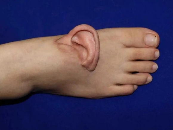  Forrás: Santug Tartományi Kórház