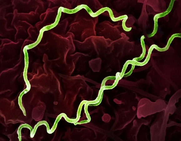 Treponema pallidum Bacteria (Syphilis) Colorized electron micrograph of Treponema pallidum, the bacteria that cause syphilis. Several spiral-shaped bacteria have been highlighted in green. (Photo by National Institute of Allergy and Infectious Diseases on Unsplash)