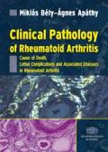 arthrosis artritisz kezelési könyv